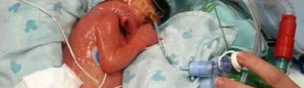 Rekli su joj da je njena novorođena beba mrtva. Ono što je uradila u nastavku šokiralo je doktore!