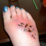 rizik-tetoviranja (5)