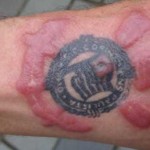 rizik-tetoviranja (6)