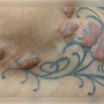 rizik-tetoviranja (7)