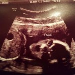 ultrazvuk-bebe (10)