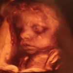 ultrazvuk-bebe (1)
