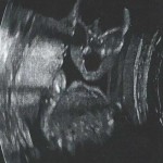 ultrazvuk-bebe (12)