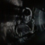 ultrazvuk-bebe (13)