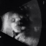 ultrazvuk-bebe (16)