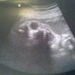 ultrazvuk-bebe (19)