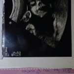 ultrazvuk-bebe (20)