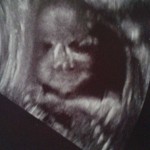 ultrazvuk-bebe (24)