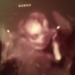 ultrazvuk-bebe (25)
