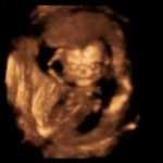 ultrazvuk-bebe (26)