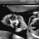 ultrazvuk-bebe (27)