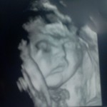 ultrazvuk-bebe (3)