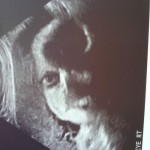 ultrazvuk-bebe (3)