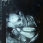 ultrazvuk-bebe (4)