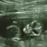 ultrazvuk-bebe (5)