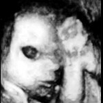 ultrazvuk-bebe (6)