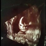 ultrazvuk-bebe (7)