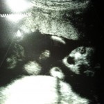 ultrazvuk-bebe (8)