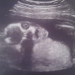 ultrazvuk-bebe (9)
